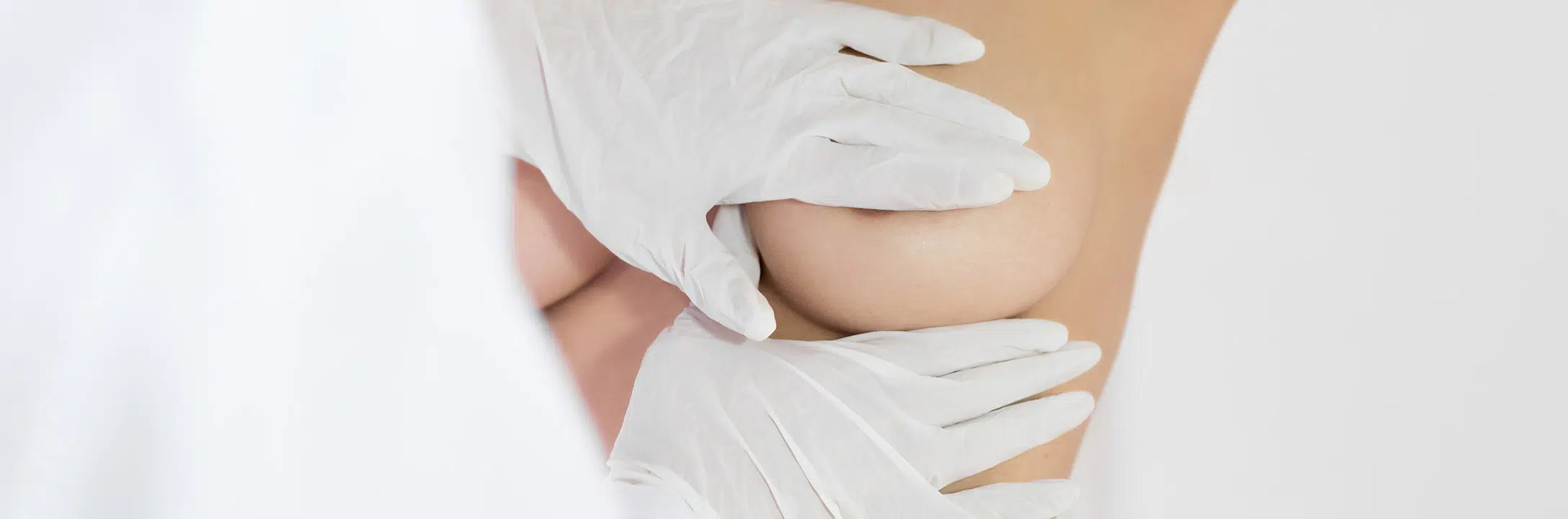 Comment modifier la forme et le volume des seins | Paris 16 | Dr Pecorelli