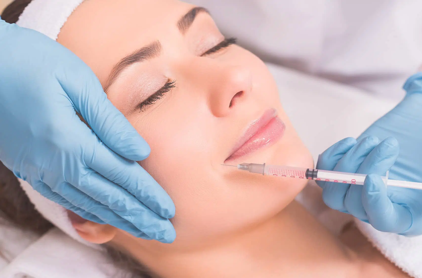 Injection acide hyaluronique : pli d’amertume | Paris 16 | Dr Pecorelli