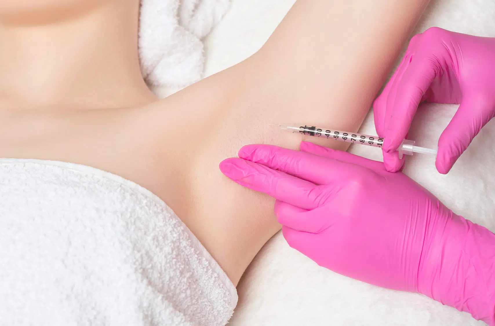 Injection de Botox aisselles : hyperhidrose | Paris 16 | Dr Pecorelli