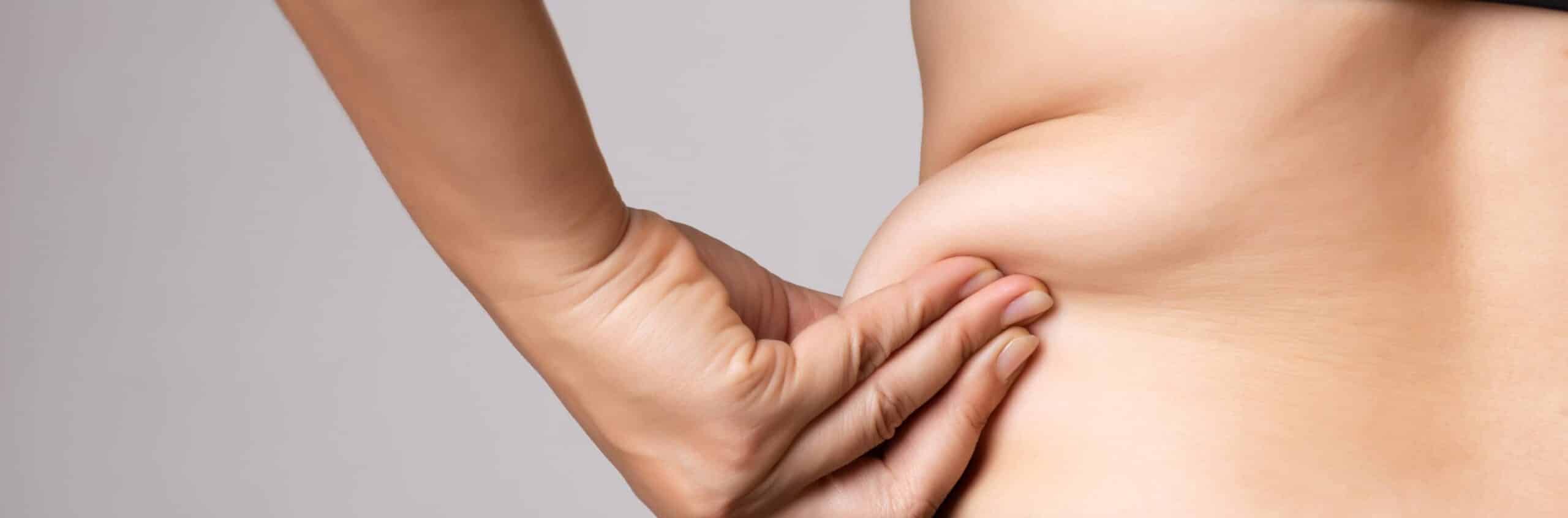 Quelles différences entre la liposuccion et la liposuccion douce ? | Dr Elisa Pecorelli| Paris