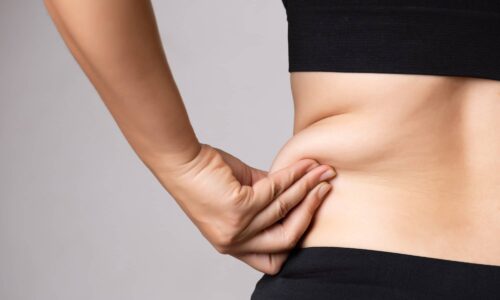 Quelles différences entre la liposuccion et la liposuccion douce ? | Dr Elisa Pecorelli| Paris