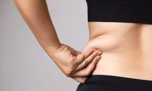 Quelles différences entre la liposuccion et la liposuccion douce ? | Dr Elisa Pecorelli| Paris