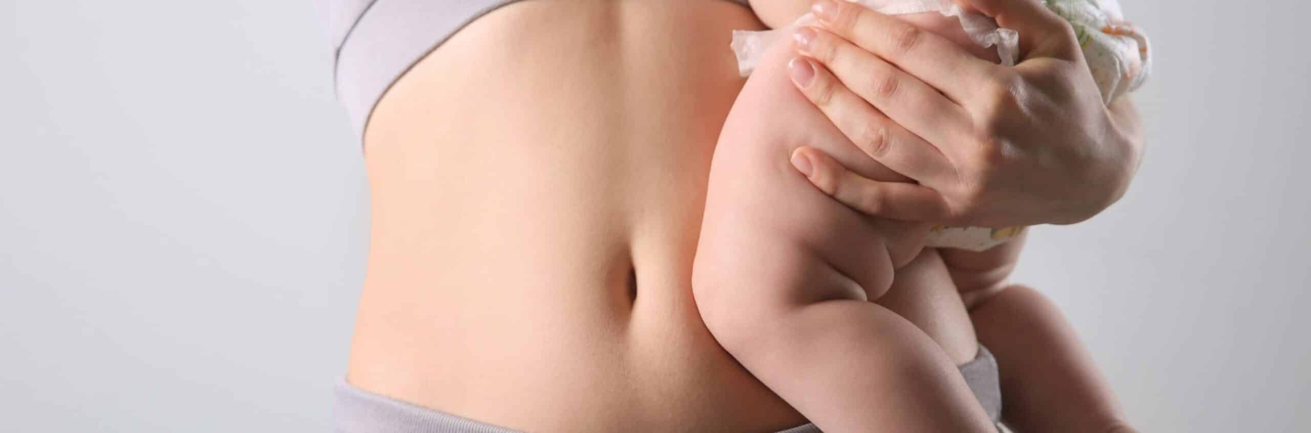 L’abdominoplastie post-partum : est-ce possible ? | Dr Elisa Pecorelli| Paris