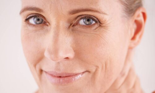 Les résultats d'un lifting du visage sont-ils naturels ? | Chirurgie esthétique, lifting cervico-facial | Dr Pecorelli | Paris