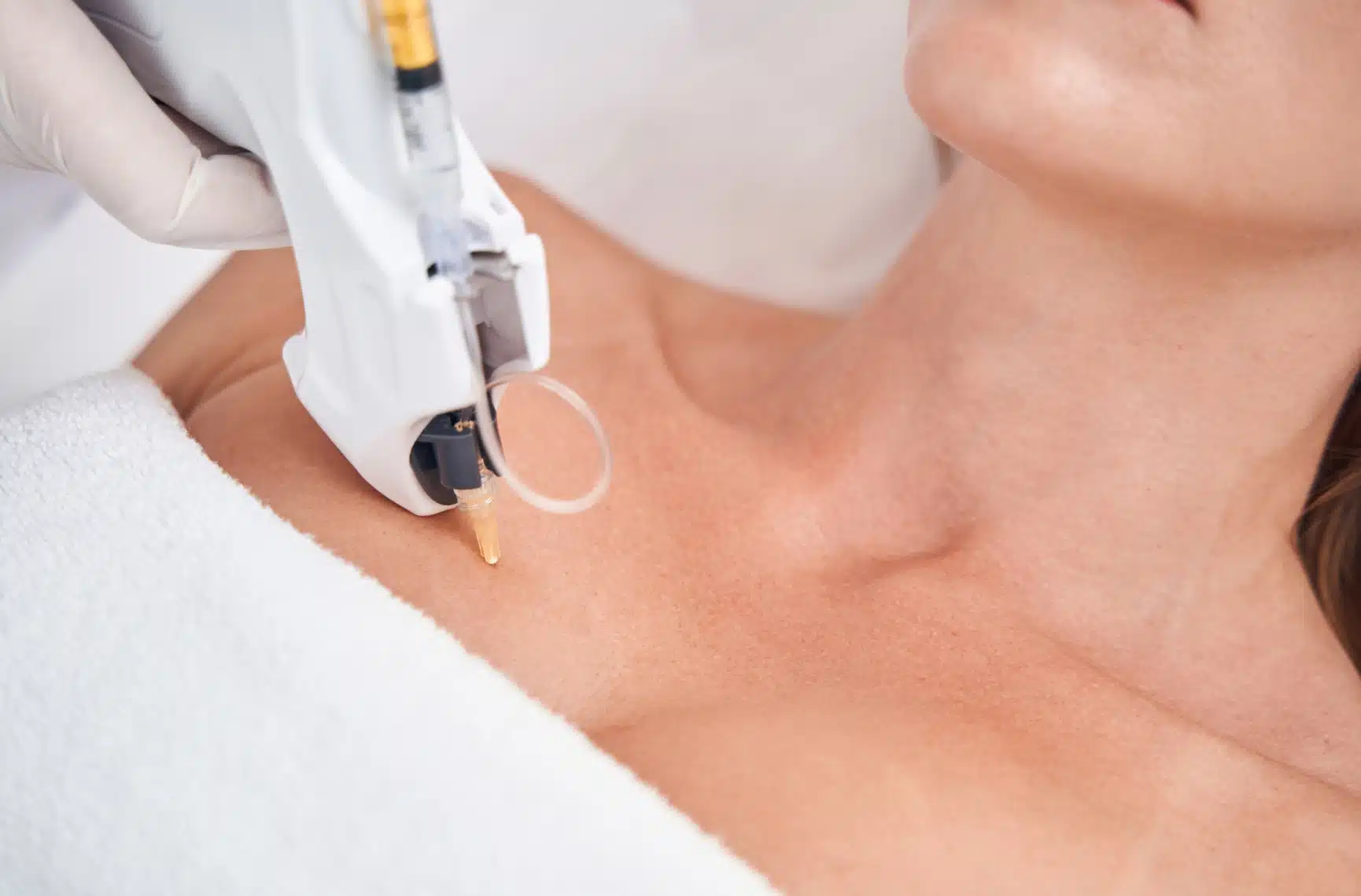 Mésothérapie cheveux et visage - Mesolift prix - | Docteur Pecorelli | Paris 16