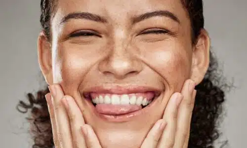 Eliminer les taches brunes avec le laser Clarity II |Dr Elisa Pecorelli | Paris