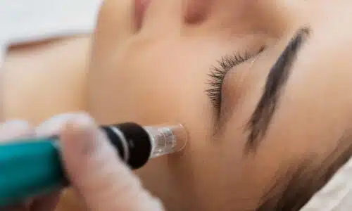 Pourquoi faire un soin Hydrafacial en hiver ? |Dr Elisa Pecorelli | Paris