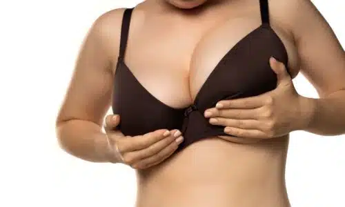 Correction de l'asymétrie mammaire avec le Dr Elisa Pecorelli à Paris