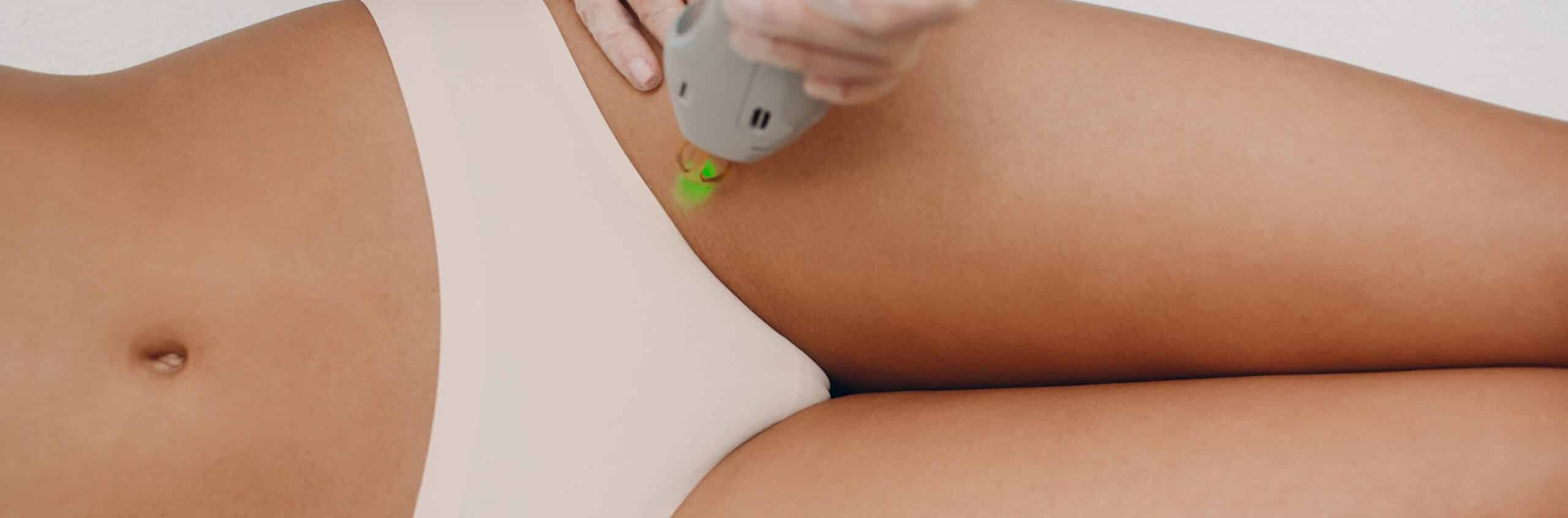 Zone épilation laser