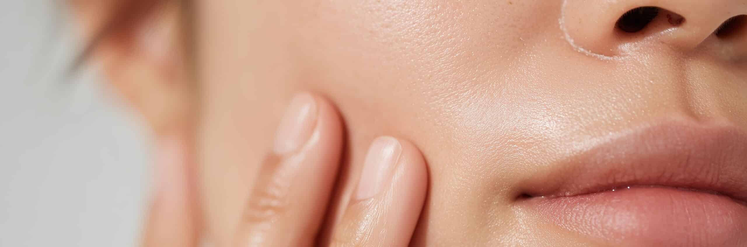 Hydrafacial acne