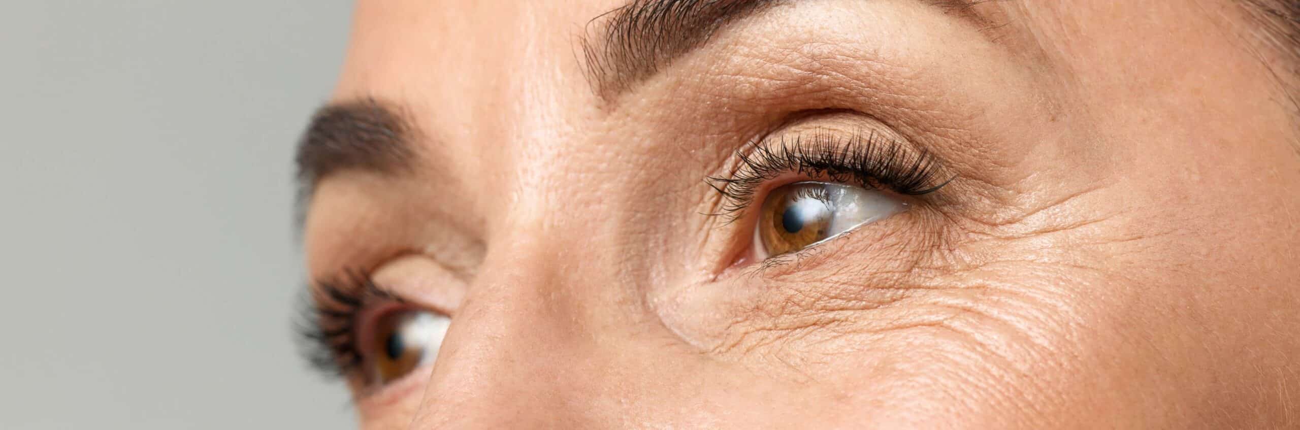 Blépharoplastie