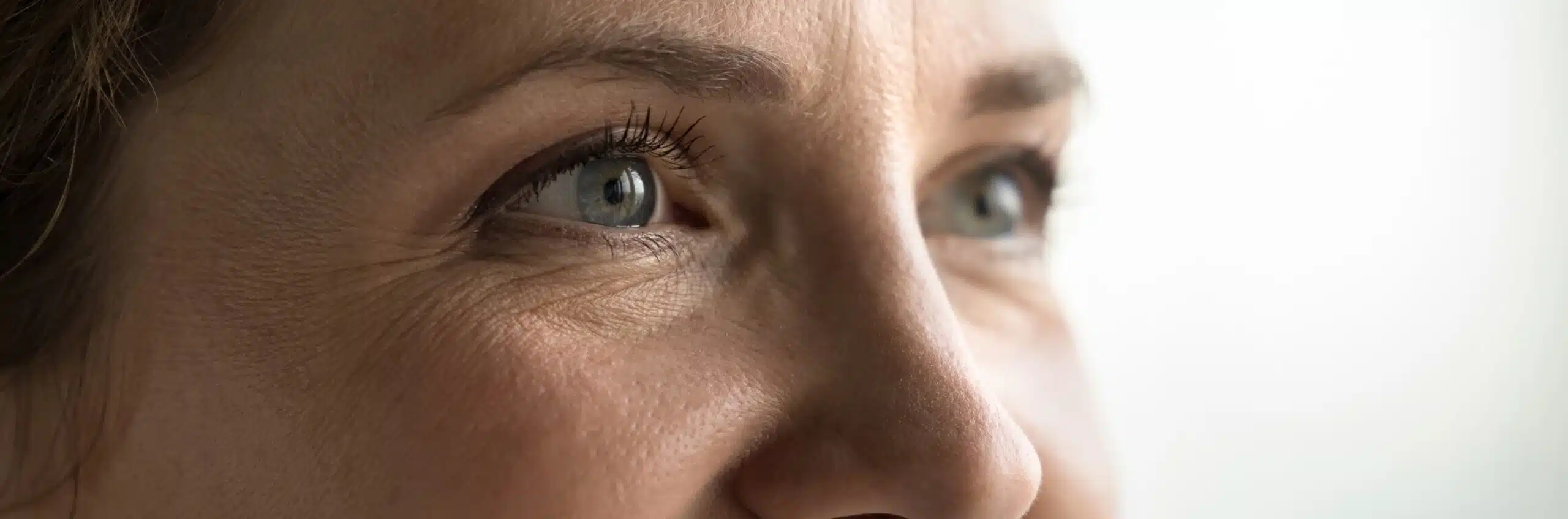 Cicatrices blépharoplastie