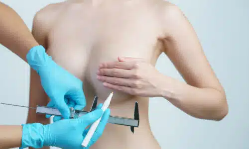 reduction mammaire prix