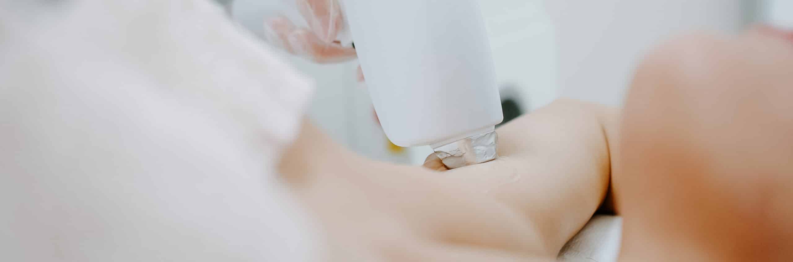 epilation laser pourquoi choisir medecin plutot centre | Dr Elisa Pecorelli | Paris