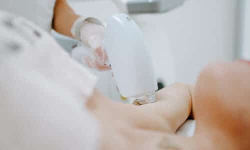 epilation laser pourquoi choisir medecin plutot centre | Dr Elisa Pecorelli | Paris