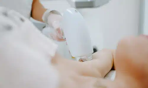 epilation laser pourquoi choisir medecin plutot centre | Dr Elisa Pecorelli | Paris