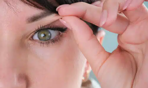 Combien coûte blépharoplastie France | Dr Elisa Pecorelli | Paris